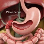 Imagem médica detalhada do estômago humano mostrando o piloro aberto e desobstruído, permitindo a passagem de alimentos para o intestino.